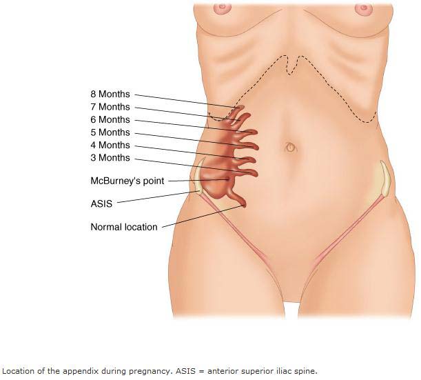 Albums 91+ Images where is your appendix located on a female picture Sharp