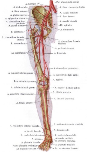 femoral artery aneurysm - ModernHeal.com