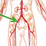 Femoral Reproductive Therapeutic Massage