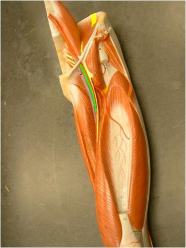 femoral artery bleeding - ModernHeal.com