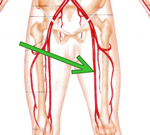 femoral artery location - ModernHeal.com