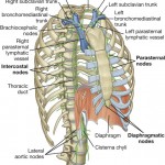 thoracic duct blockage