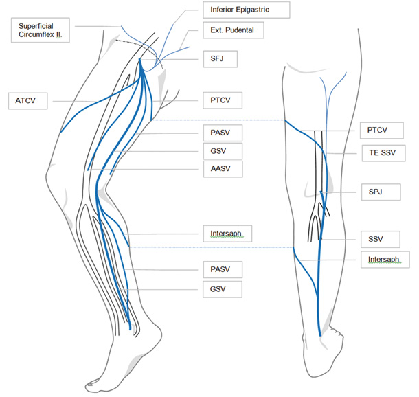 icd 10 code for superficial thrombophlebitis right greater saphenous vein