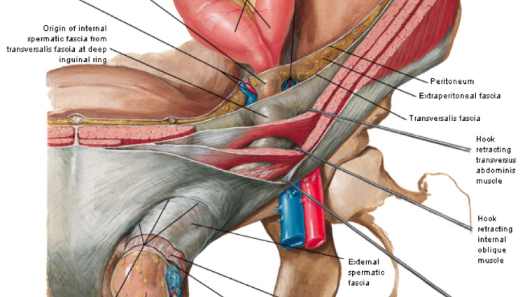 inguinal ligament ct - ModernHeal.com