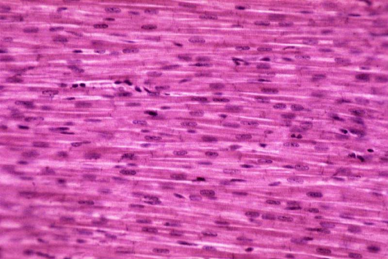 intercalated discs in cardiac muscle - ModernHeal.com