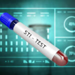 STD blood test