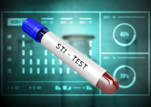 STD blood test